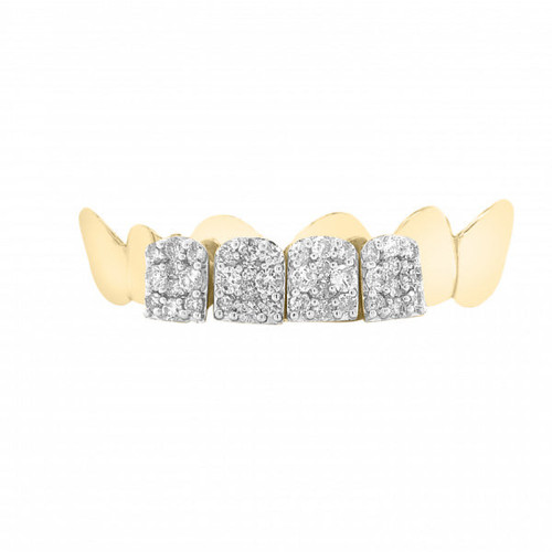 Diamond grillz Exotic Diamond San Antonio.1