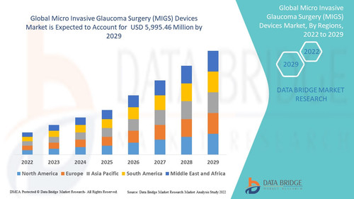 Micro Invasive Glaucoma Surgery (MIGS) Devices Market.jpg