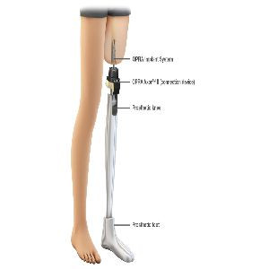 limb2.jpg