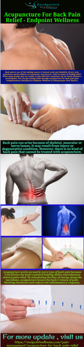 Acupuncture For Back Pain Relief Endpoint Wellness.png