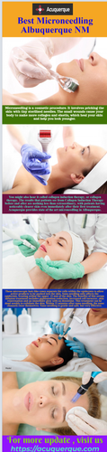 Best Microneedling Albuquerque NM.png