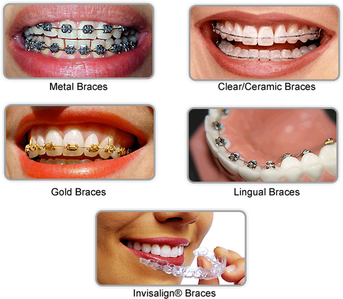 Perfect Smile Experience the Magic of Invisalign Treatment.png