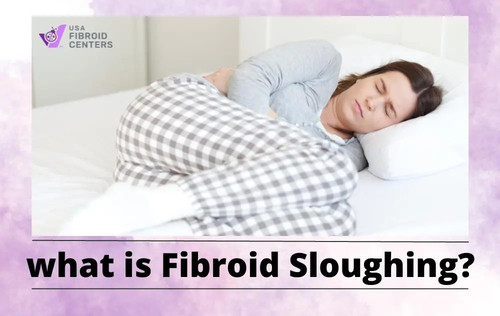 What is Fibroid Sloughing?.jpg