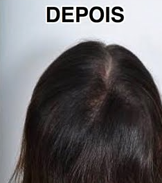 cztwJYKLEbdlVZ2.webp