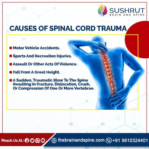 CAUSE OF SPINAL CORD TRAUMA.jpg