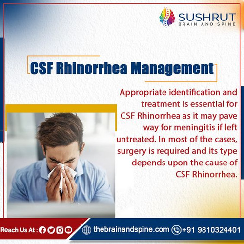 CSF Rhinorrhea Managements.jpg