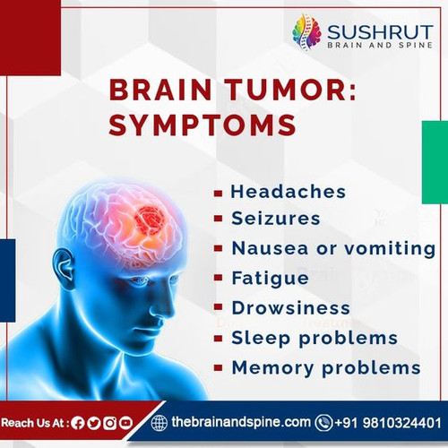 Symptoms of Brain Tumor are.jpg