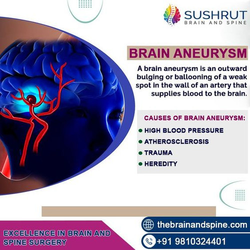 BRAIN ANEURYSM.jpg