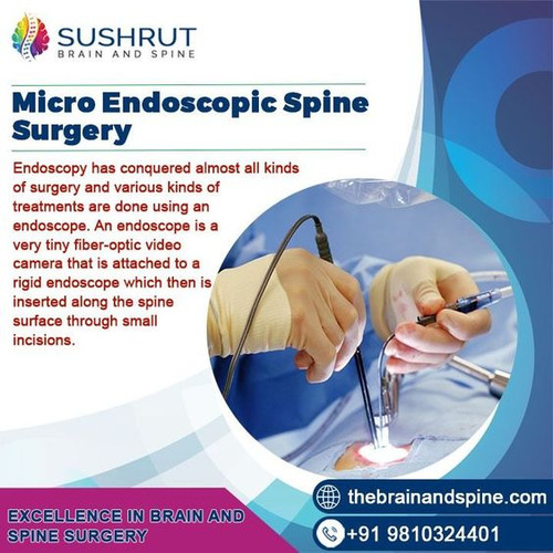 Micro Endoscopic Spine Surgery.jpg