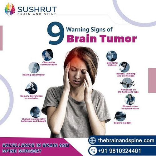9 Warning Signs of Brain Tumor.jpg