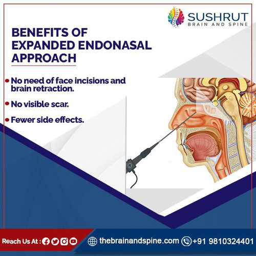 BENEFITS OF EXPANDED ENDONASAL APPROACH.jpg