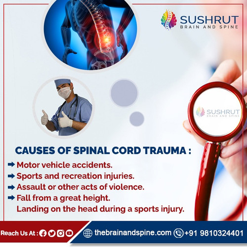 CAUSES OF SPINAL CORD TRAUMAs.jpg