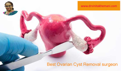 Dr. Vinita Khemani: Best Ovarian Cyst Surgery Treatment in Kolkata.jpg