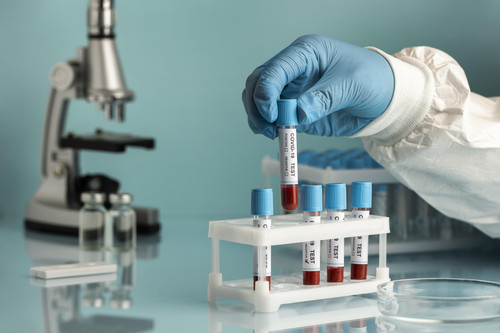 Hand with protective gloves holding a blood samples for covid test.jpg