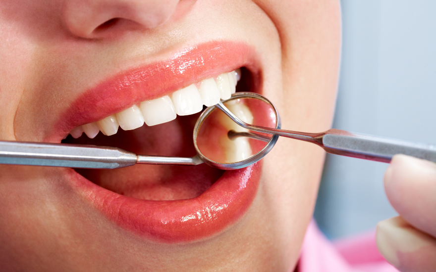 Cosmetic dental checkup