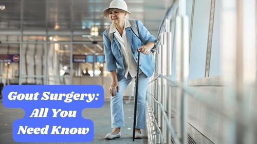 Gout Surgery: All You Need Know.jpg