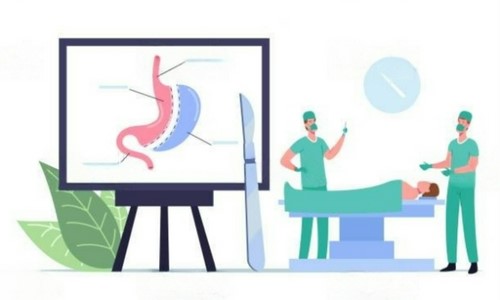 Gastric Balloon Abu Dhabi.jpg