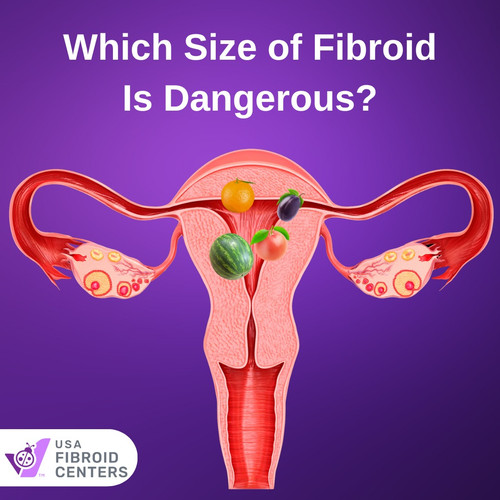 Which Size of Fibroid Is dangerous.jpg