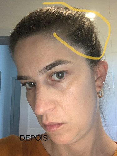 br 11134103 22110 2c5tndbtx3jv6c.jpg