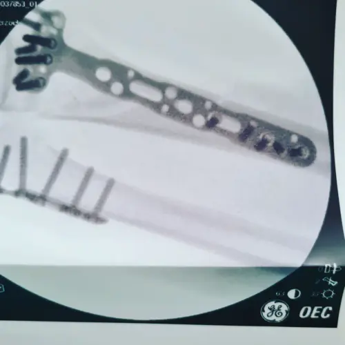 IMG 20220527 221039 552.webp