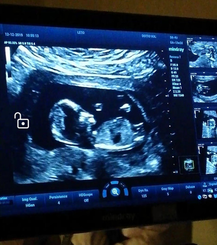 Screenshot 20191212 114442.jpg