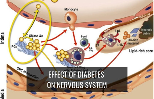 Effects  of  diabetes on  gastrointestinal system ,blood  vessels, wounds and infections,vision and.jpg