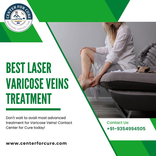 Varicose Veins Laser Surgery in Lucknow (1).jpg
