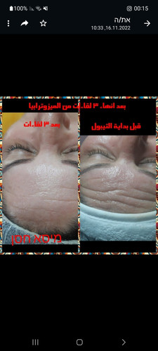1000114517.jpg