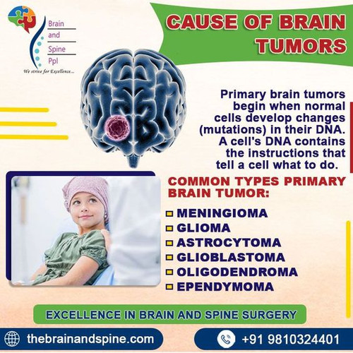 CAUSE OF BRAIN TUMORS.jpg