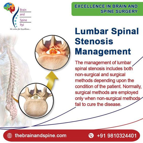 Lumbar Spinal Stenosis Management.jpg