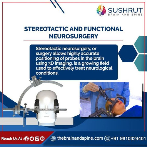 STEREOTACTIC AND FUNCTIONAL NEUROSURGERY.jpg