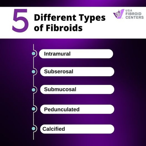Different Types of Fibroid.jpg