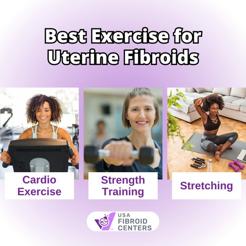 Best Exercise for Uterine Fibroids.jpg