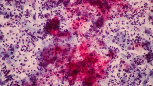 Hh7MfV9.md.jpg
