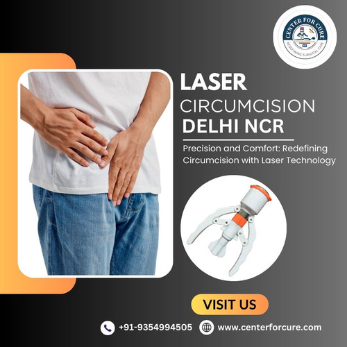Stapler Circumcision Surgery in Noida.jpg