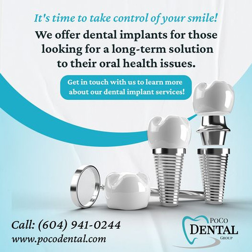 dental implants.jpg