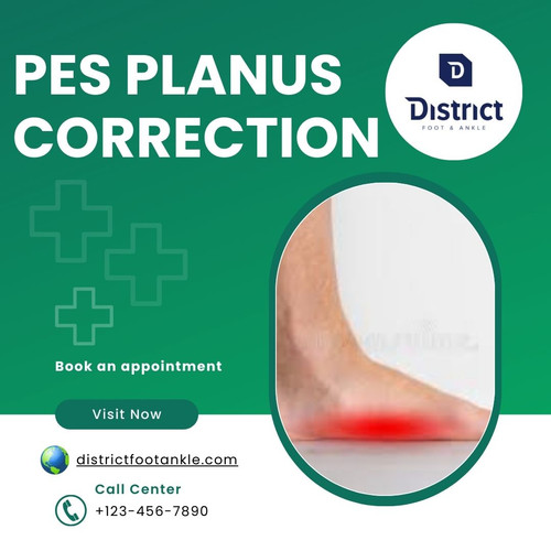 Pes Planus Correction.jpg