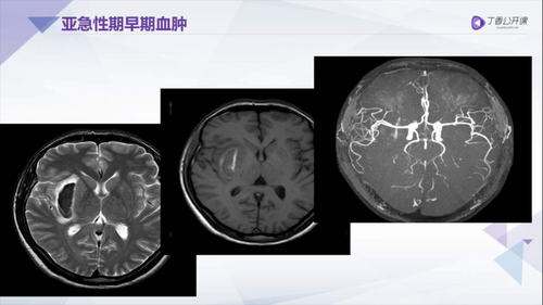 vlcsnap 2022 12 12 15h53m11s583.png