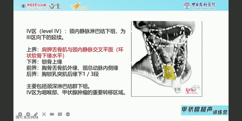 vlcsnap 2022 12 12 15h43m14s397.png