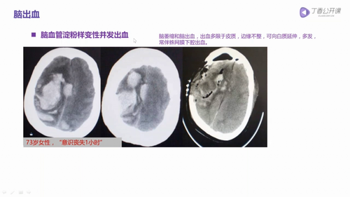 vlcsnap 2022 12 12 16h07m07s109.png