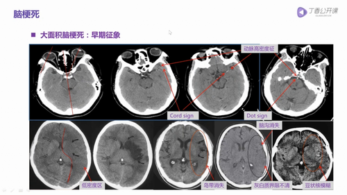 vlcsnap 2022 12 12 16h06m58s790.png