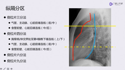 vlcsnap 2022 12 13 17h30m31s354.png