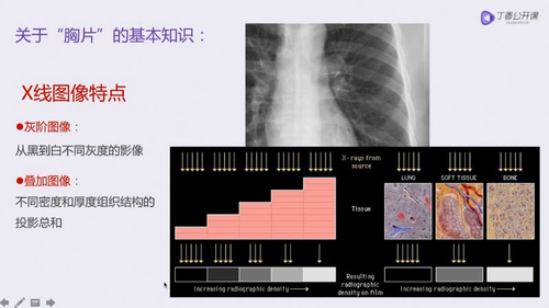 vlcsnap 2022 12 13 17h30m26s265.png