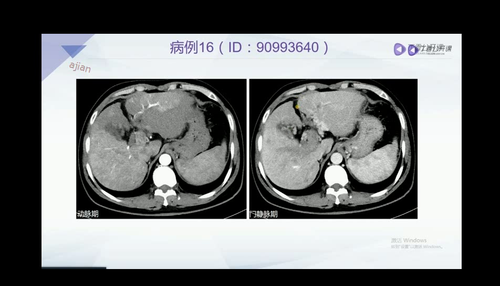 vlcsnap 2022 12 13 17h36m11s357.png