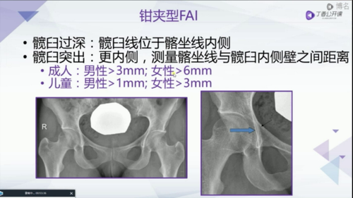 vlcsnap 2022 12 13 17h24m12s043.png