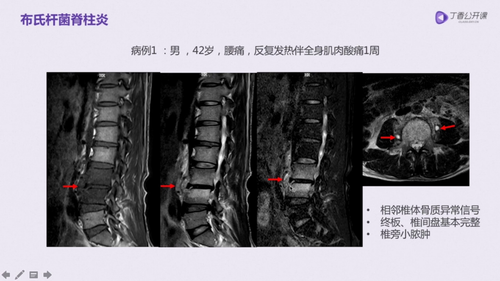 vlcsnap 2022 12 13 17h40m48s182.png