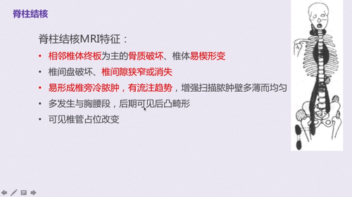 vlcsnap 2022 12 13 17h40m43s097.png