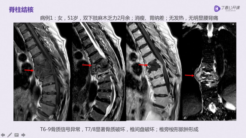 vlcsnap 2022 12 13 17h40m37s725.png