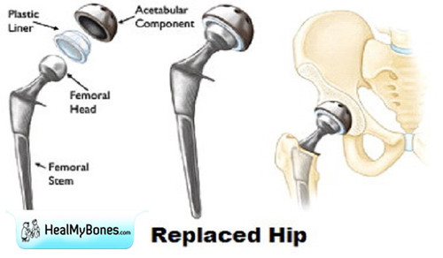Highly Renowned Hip Replacement Doctor in Kolkata: Dr. Manoj Kumar Khemani.jpg