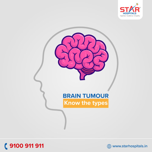 Best Neuro Hospital in Hyderabad.jpg